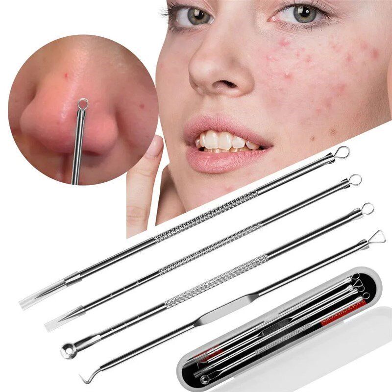 Luxury Skincare Acne - Kit d'outils pour éliminer les points