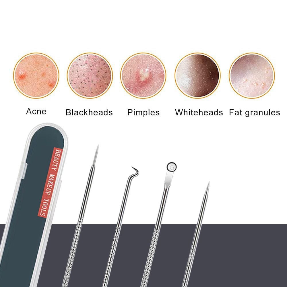 Kit d'outils anti-boutons et e - Luxury Skincare Acne avis et prix