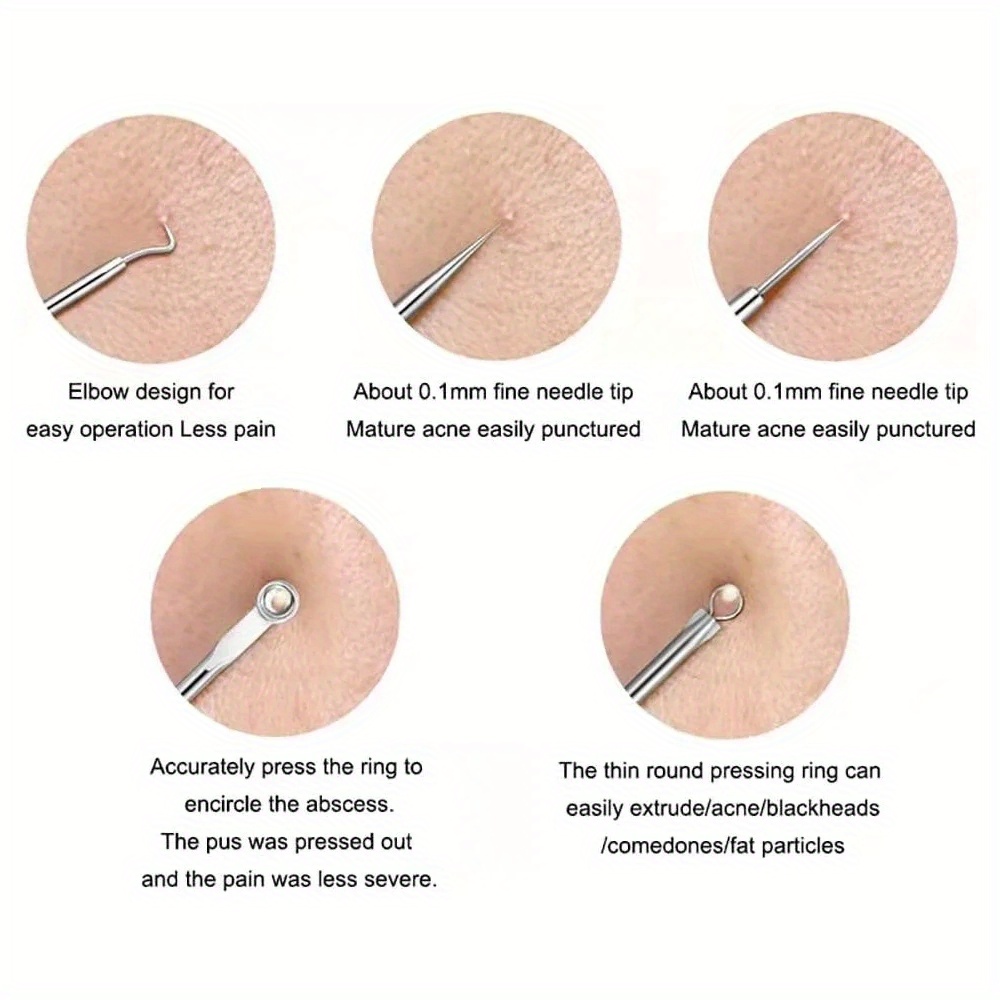 Kit d'outils anti-boutons et e - Luxury Skincare Acne avis et prix