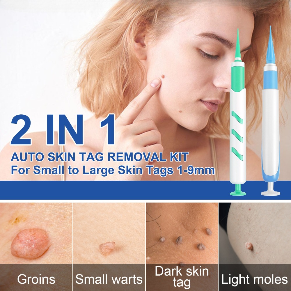 Kit d'outils d'élimination aut - Luxury Skincare Acne avis et prix
