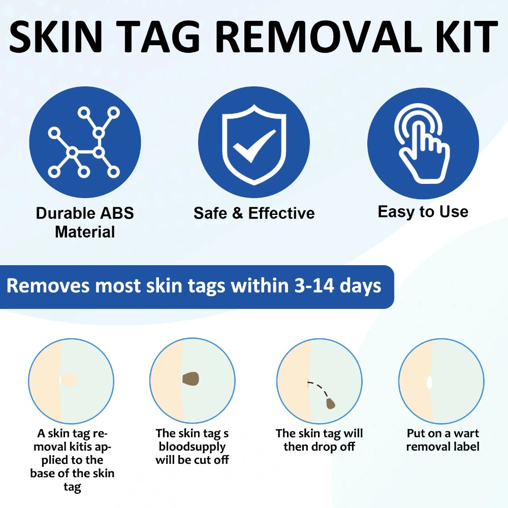 Kit d'outils d'élimination aut - Luxury Skincare Acne avis et prix