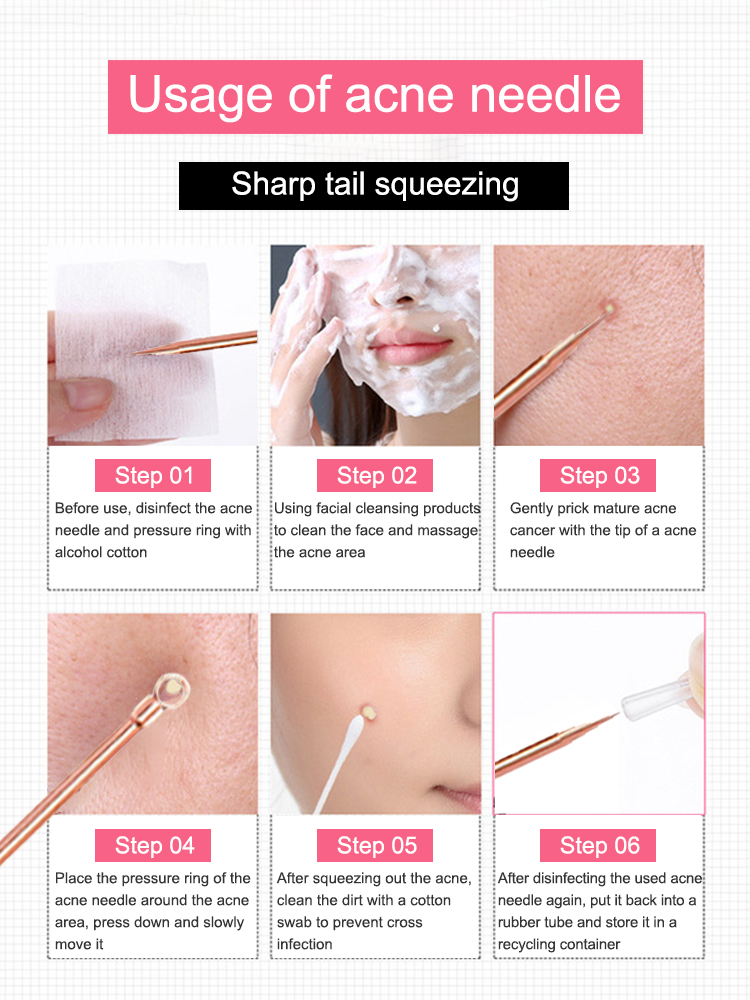 Extracteur de points noirs, ou - Luxury Skincare Acne avis et prix