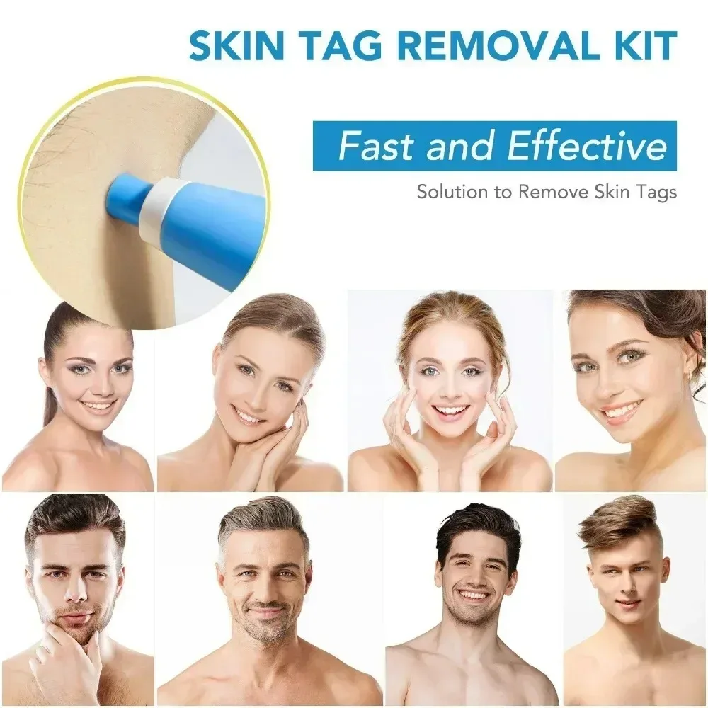 Dissolvant d'acné 2 en 1, Micr - Luxury Skincare Acne avis et prix